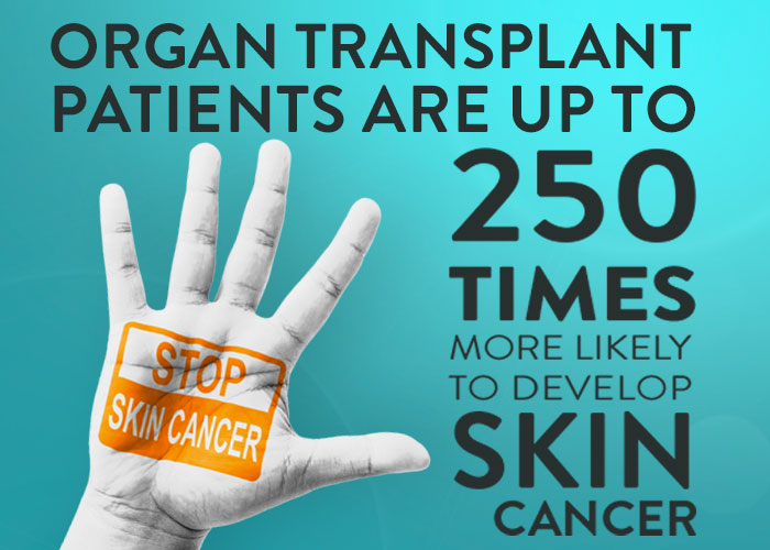 Skin Cancer After Organ Transplant
